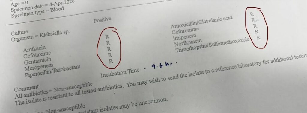 Sri Lanka Faces Alarming Rise in Pan-Resistant Bacteria: A Newborn Blood Culture Shows Resistance to Every Tested Antibiotic