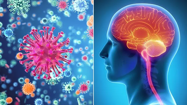 Sri Lanka Enteroviral Meningitis 2026: Ministry Guidelines Explained